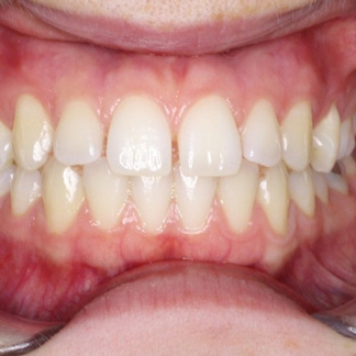 naim-before-2